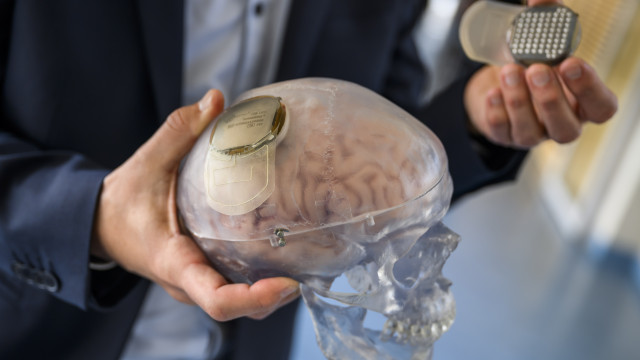 Breakthrough in science: world's first 3D brain tissue printed